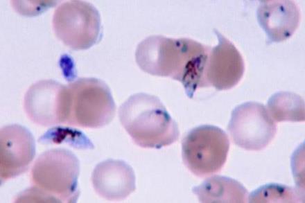 Plasmodium