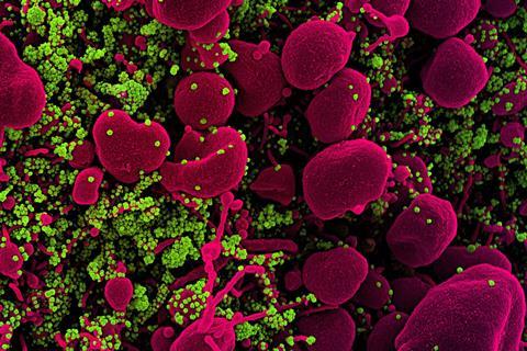 Novel_Coronavirus_SARS-CoV-2_(49919537436)