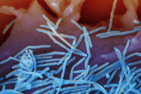 Human_Respiratory_Syncytial_Virus_(RSV)_-_52453988775