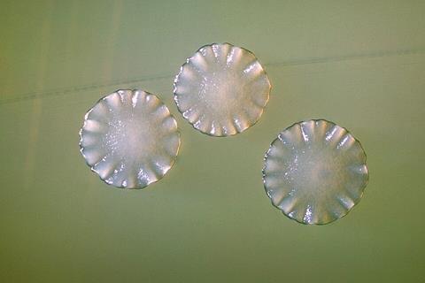 Actinomyces_spp_01