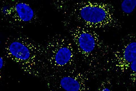 Low-Res_Dengue infected cells