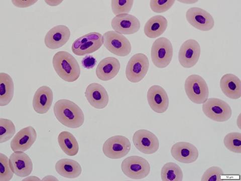 Low-Res_Banded watersnake blood with Hepatozoon sp_