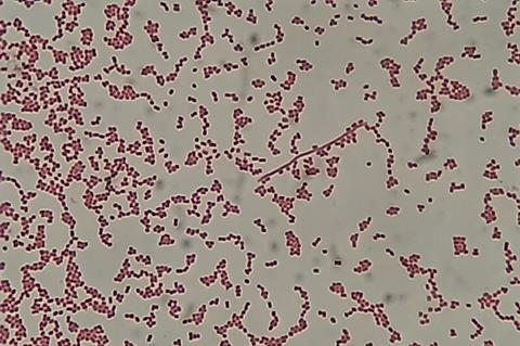 Gram_-negative_cocci_(GNC)_and_Gram_-negative_rod_(GNR)_of_Acinetobactet_baumannii_in_Gram_staining