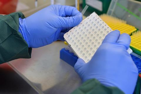 Preparation of RT-PCR reaction