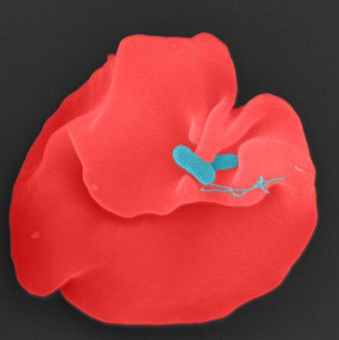 Low-Res_Bartonella bacilliformis_1000x1000c_Juergen_Berger_MPl_Biology_Tuebingen