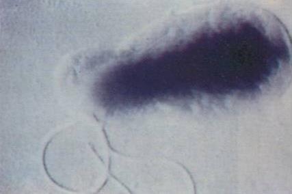 Bartonella