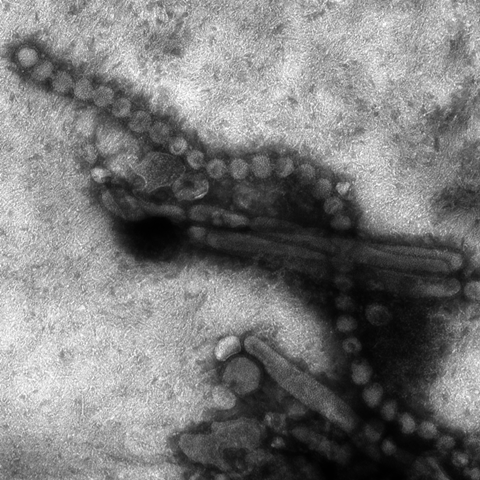 Electron_micrograph_of_Influenza_A_H7N9