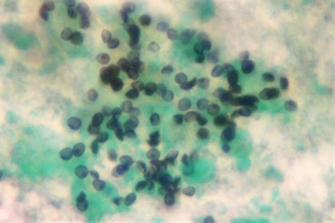 Pneumocystisjiroveci