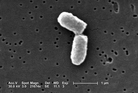 Ecoli_dividing