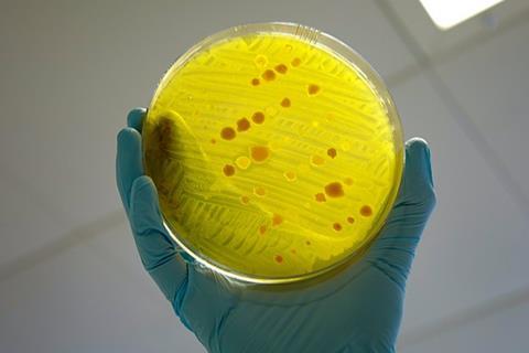 Antimicrobial_resistance