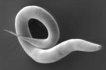 Electron_micrograph_of_''Caenorhabditis_elegans''