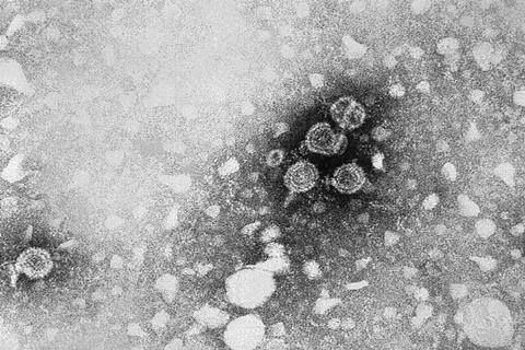 Hepatitis_B_virus_01