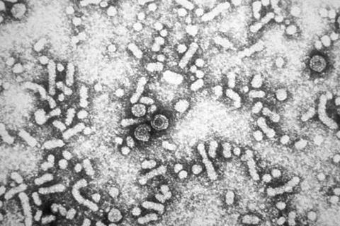 Hepatitis-B_virions