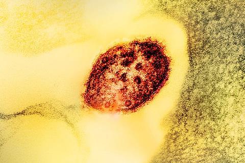 Measles_Virus_Particle