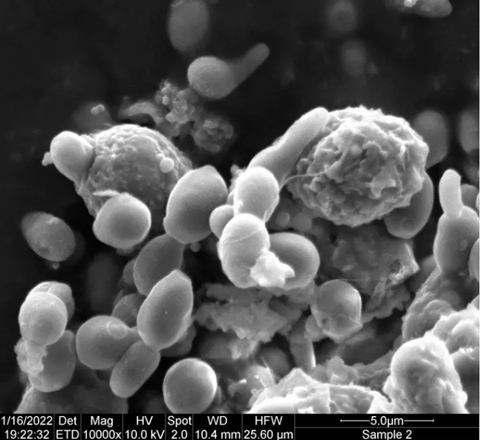 eosin