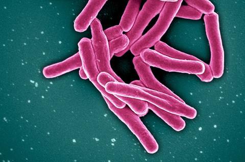 Mycobacterium_Tuberculosis_Bacteria,_the_Cause_of_TB_(52766234986)