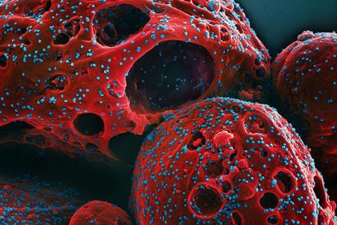 Novel_Coronavirus_SARS-CoV-2_(Omicron)_(52488777518)