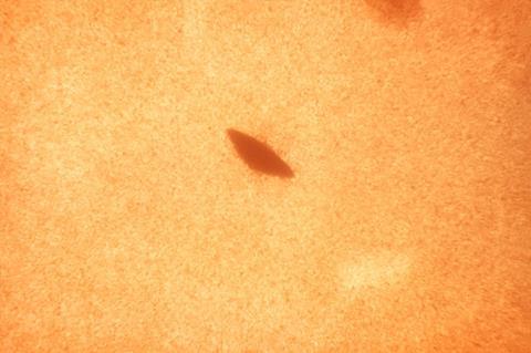 lossy-page1-800px-Streptococcus_salivarius.tif