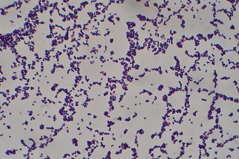 Staphylococcus_aureus_Gram_stain