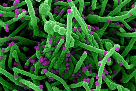 Novel_Coronavirus_SARS-Cov-2_(50010217143)