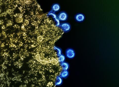 HIV_Virus_Particles_-_53567924670