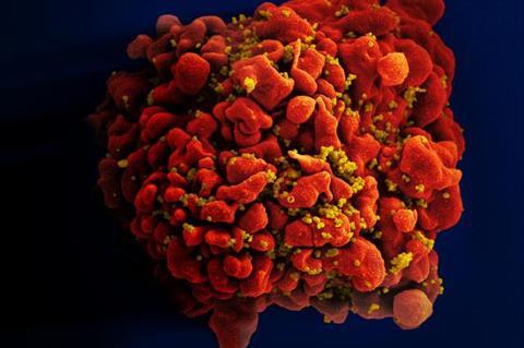 HIV-infected_H9_T_Cell_(6813314147)