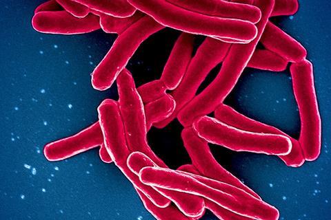 Mycobacterium_Tuberculosis_Bacteria,_the_Cause_of_TB_(52765697337)