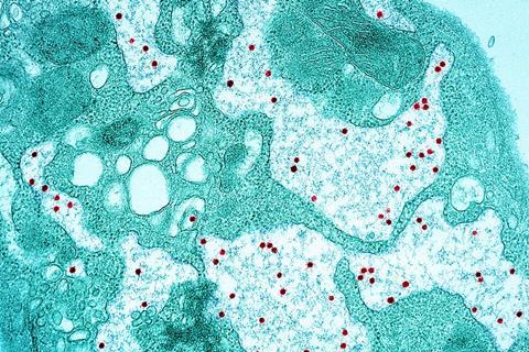 Colorized_transmission_electron_micrograph_of_yellow_fever_virus_particles_(red)_found_within_enlarged_cytoplasmic_vesicles_of_a_C6-36_cell_(teal)