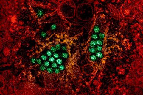 Dengue_Virus_Particles_(53231045112)