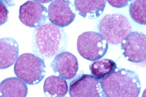 800px-Epstein-barr_virus_(ebv) (1)