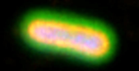 Low-Res_Klebsiella pneumoniae