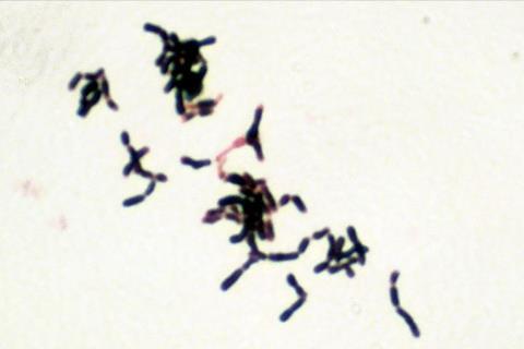 Bifidobacterium_adolescentis_Gram