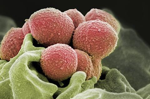 <i>Streptococcus pyogenes (Group A Strep)</i>