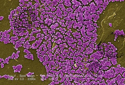 Methicillin-resistant_Staphylococcus_aureus_10047