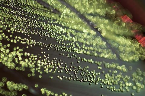 1024px-Escherichia_coli_EMB