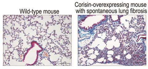 Low-Res_Lung tissue-m