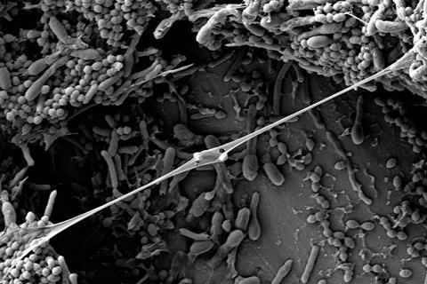 Mixed-culture biofilm