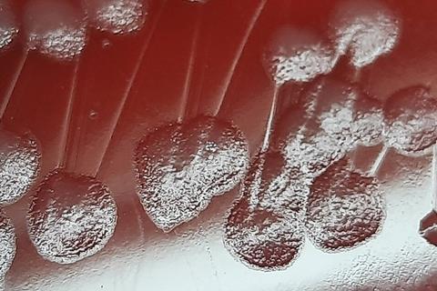 Pseudomonas_aeruginosa_colony_morphology_on_blood_agar