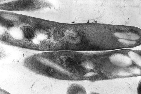 800px-Mycobacterium_tuberculosis_01