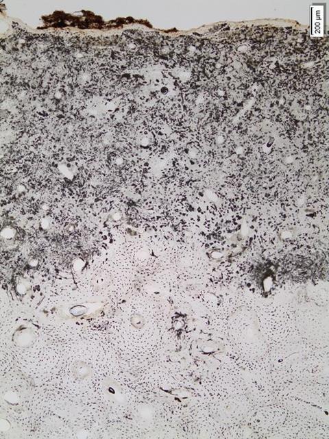 Low-Res_Bone, Stavanger