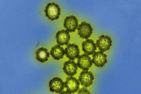 H1N1_Influenza_Virus_Particles_(8411599236)
