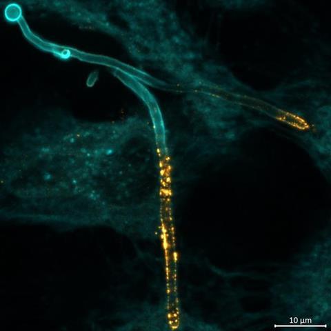 Low-Res_2024-03-13_Leibniz-HKI_Candida-albicans-invades-host-epithelial-cells