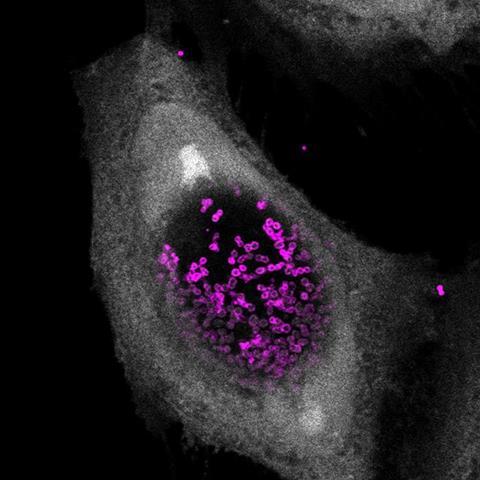 Low-Res_Human cell infected with Chlamydia janas
