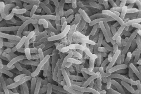 Cholera_bacteria_SEM