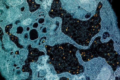 Yellow_fever_virus