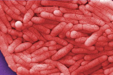 OSC_Microbio_04_02_Salmonella