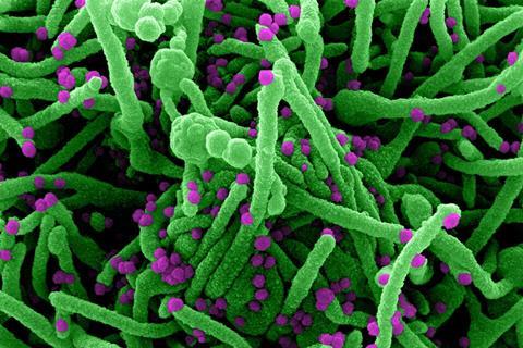 Novel_Coronavirus_SARS-Cov-2_(50010217143)