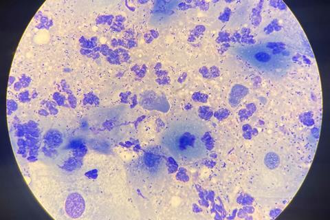 Chlamydia-22Feb25