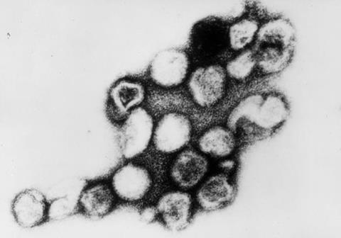 Rubella_virus_TEM_B82-0203_lores