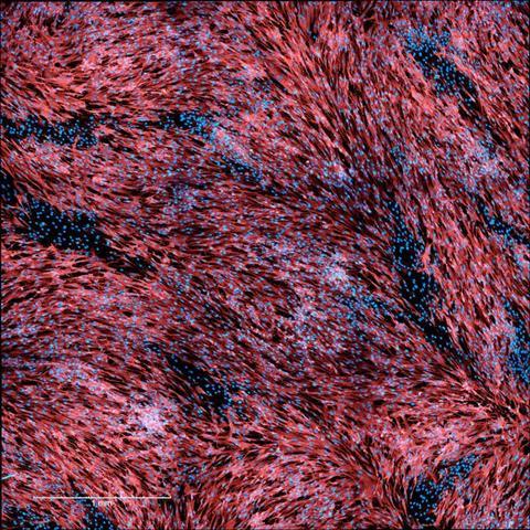 Low-Res_HF_MPXV_semen_Torbica_et_al_EmergingMicrobesInfections_2026